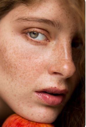 Pigmentation After Pregnancy: What’s Normal, What’s Not, and What Helps