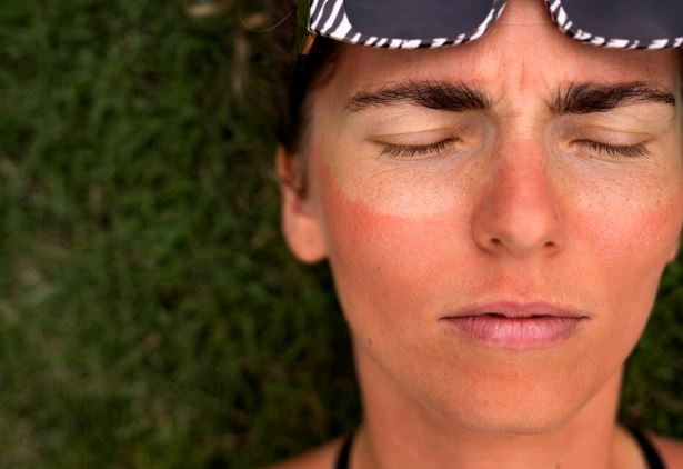 Your Sun Spots Aren’t Harmless — But They’re Fixable