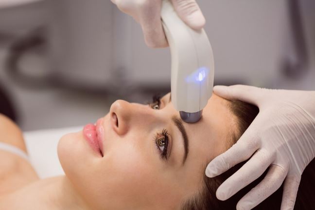bbl laser treatment