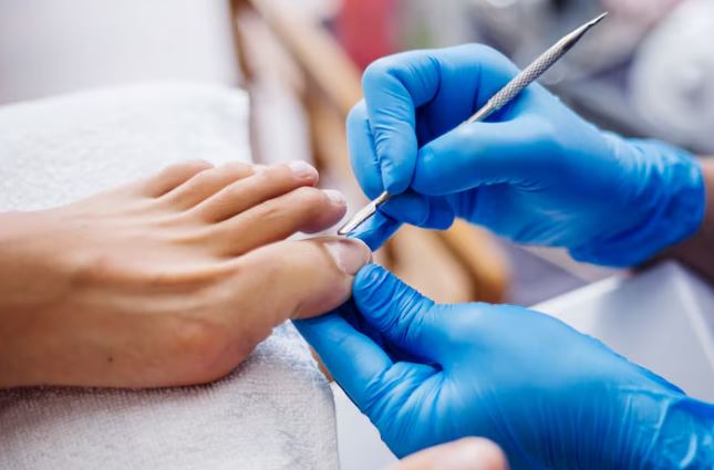 fungal nail laser treatment