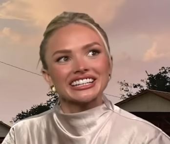 natalie alyn lind plastic surgery